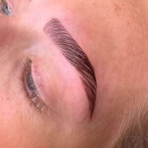 Brow Lifting<BR>18/11