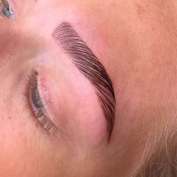 Brow Lifting<BR>18/11